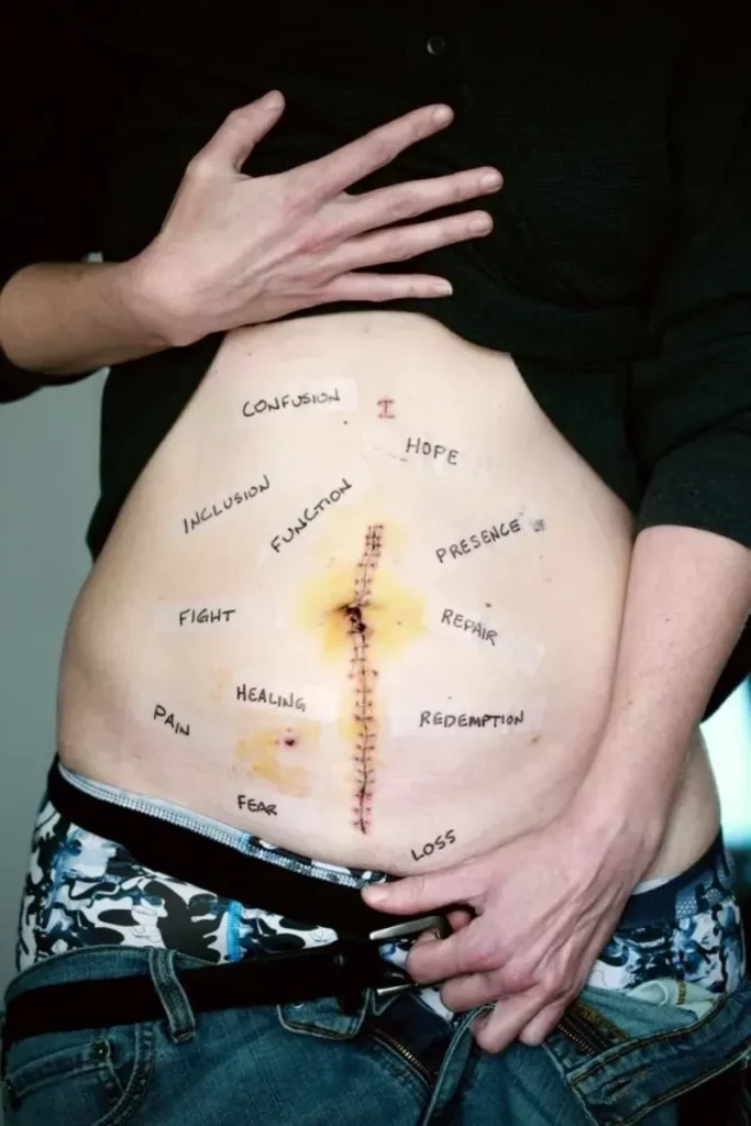 words written on a person's stomach