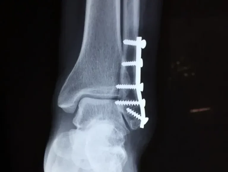 The DAMAGE Is Done. . . Not Just A Song By Foreigner!